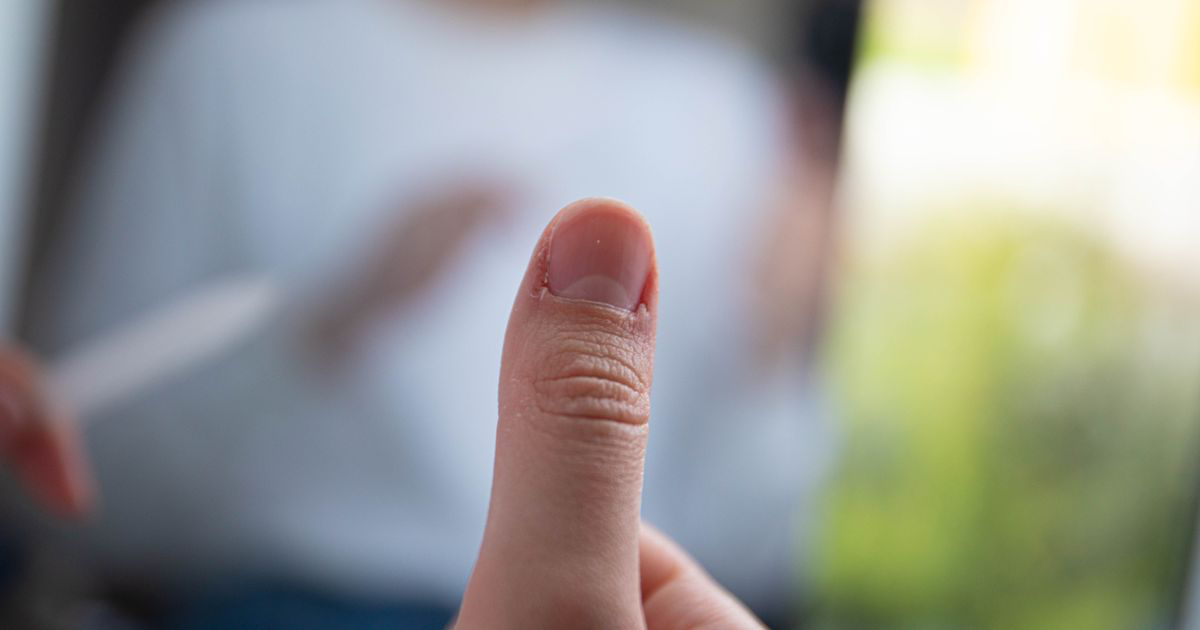 Why Do My Nail Photos Look Blurry?